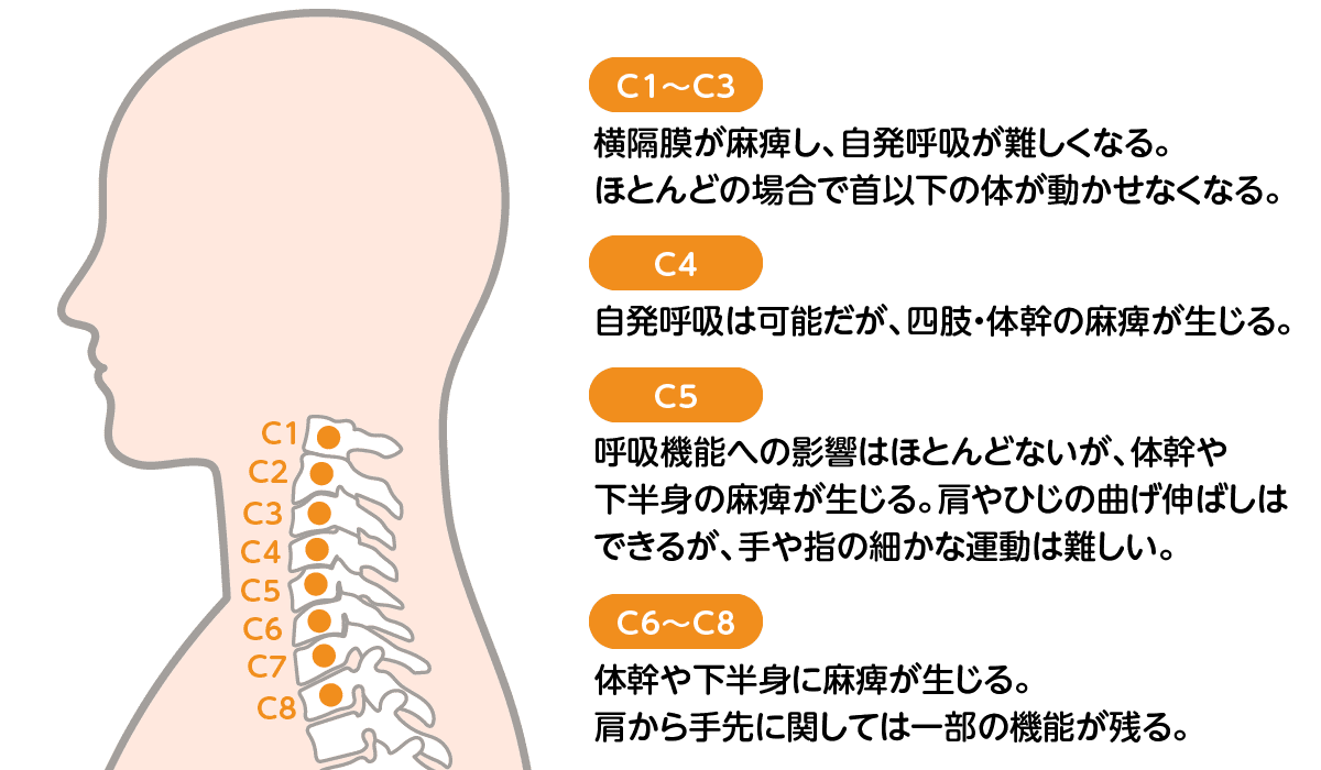 頚髄損傷の症状_CUC